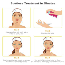 Load image into Gallery viewer, 10-Piece: Blackhead Remover Tool