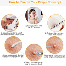 Load image into Gallery viewer, 5-Piece Set: Blackhead Remover Kit Stainless Steel Popping Zit Remover