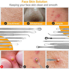 将图片加载到图库查看器,7-Pieces: Blackhead Remover Stainless Steel