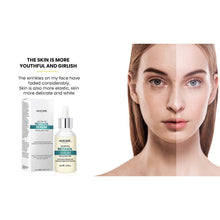 Load image into Gallery viewer, Amore Paris 2.5% Retinol Serum For Face With Hyaluronic Acid Night Facial Serum