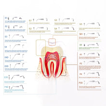 Load image into Gallery viewer, AZDENT Dental Ultrasonic Scaler Tip Scaling Periodontics Endodontics Endo Perio Scaling Tips G P E fit for EMS and WOODPECKER