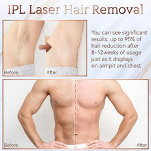 Load image into Gallery viewer, IPL Laser Epilator – Painless Hair Removal Device