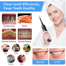 Load image into Gallery viewer, LED Electric Sonic Scaler Toothbrush Set Stains Dental Calculus Remover Tooth Cleaner Teeth Whitening Oral Irrigation Care Tools