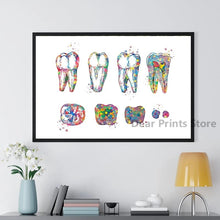 Load image into Gallery viewer, Dental Equipment Medical Posters and Prints Teeth Anatomy Watercolor Art Picture Canvas Painting Dentist Gift Clinic Wall Decor