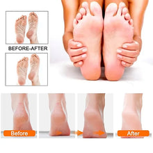 Load image into Gallery viewer, Rechargeable Electric Foot File 1+10 Set Callus Remover Machine Pedicure Device Foot Care Tools For Heels Remove Dead Skin black