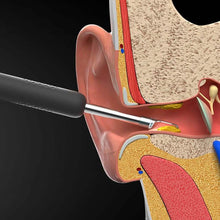 将图片加载到图库查看器,Bebird R1 Wireless Intelligent Visual Otoscope Ear Cleaner