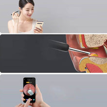 将图片加载到图库查看器,Bebird R1 Wireless Intelligent Visual Otoscope Ear Cleaner