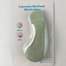 将图片加载到图库查看器,Blackhead Remover Tool Extractor
