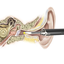 Load image into Gallery viewer, Intelligent Visual Ear Otoscope Inspection Tool