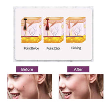 Load image into Gallery viewer, Portable Multi Level Beauty Equipment