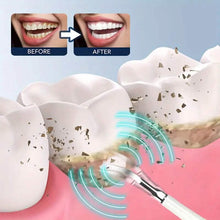 Load image into Gallery viewer, ProClean Electric Teeth Whitening Tool Set
