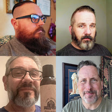 Load image into Gallery viewer, Thinning Hair Kit