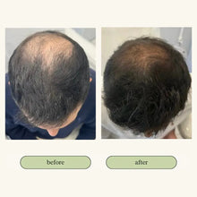 将图片加载到图库查看器,Vital Hair Trio Bundle