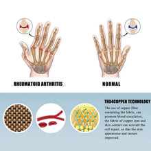 将图片加载到图库查看器，2-Pairs: Rheumatoid Arthritis Magnetic Compression Gloves
