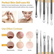 Load image into Gallery viewer, 5-Pieces Set: BlackHead Remover Kit Pimple Comedone Extractor Tool Set

