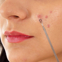 将图片加载到图库查看器，7-Pieces: Blackhead Remover Stainless Steel
