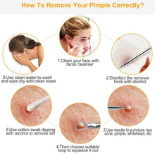 将图片加载到图库查看器，7-Pieces: Blackhead Remover Stainless Steel
