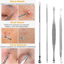 将图片加载到图库查看器，7-Pieces: Blackhead Remover Stainless Steel
