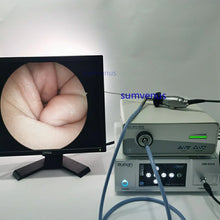 Load image into Gallery viewer, HD 2.7mm 4mm 0 30 45 70 90 degree Medical Surgical Rigid Endoscope Sinusoscope ENT Endoscopy Camera
