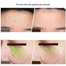 Load image into Gallery viewer, EMS Facial Body Radio Frequency Machine Skin Tightening Face Lifting RF Beauty Device Professional Home RF Skin Care Anti Aging
