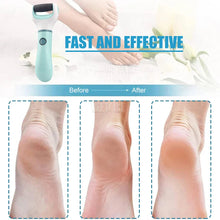 Load image into Gallery viewer, Electric Foot Grinder - Wireless Pedicure Tool for Dead Skin, Calluses, and Cracks

