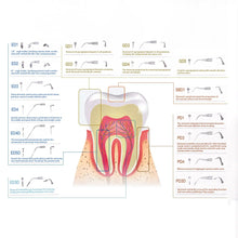 将图片加载到图库查看器，AZDENT 1pc Dental Ultrasonic Scaler Tip Scaling Periodontics Endodontics GD PD ED Tip Fit for SATELEC DTE NSK Ultrasonic Scaler
