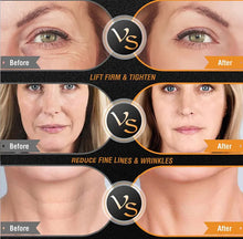 Load image into Gallery viewer, EMS Facial Body Radio Frequency Machine Skin Tightening Face Lifting RF Beauty Device Professional Home RF Skin Care Anti Aging
