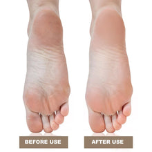 Load image into Gallery viewer, Electric Foot Callus Remover Foot Care File Heels Dead Skin Pedicure Tool Electronic Foot Grinder with 60 Replacement Sandpaper
