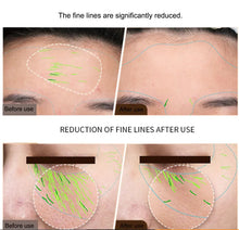 Load image into Gallery viewer, EMS Facial Body Radio Frequency Machine Skin Tightening Face Lifting RF Beauty Device Professional Home RF Skin Care Anti Aging
