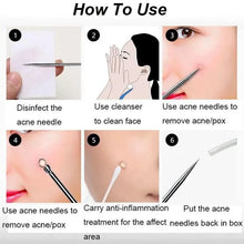 Load image into Gallery viewer, Acne Removal Tools Pimple Blackhead Remover Facial Pore Cleaner Stainless Steel with case - Skin Care tools
