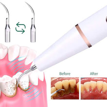 将图片加载到图库查看器，Advanced Electric Teeth Cleaning Tool Powerful Calculus Remover &amp; Tartar Eraser
