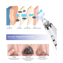 Load image into Gallery viewer, Blackhead Pore Vacuum Cleaner Remover
