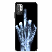 Load image into Gallery viewer, Classic Pattern Soft Slim Gel Silicone  Back Cover Case For Xiaomi Redmi Note 10 5G Case Shockproof Soft silicone Back Cover For Redmi Note 10 5G Phone Cases Note10 5G Cute Cartoon
