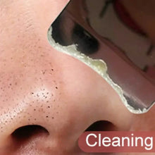 将图片加载到图库查看器，Facial Blackhead Removal Pore Cleaning Skin Scraper Tool
