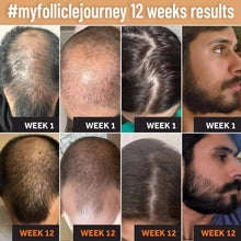 Load image into Gallery viewer, Hair Oil-Biotin Serum Treatment for Stronger Thicker Longer Hair
