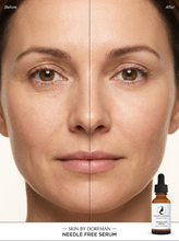 将图片加载到图库查看器，Needle Free Serum

